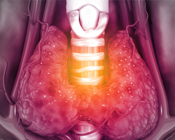 Thyroid Surgery